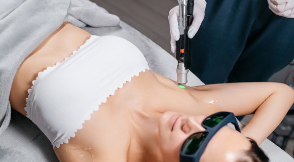 Épilation laser médicale avec technologie de dernière génération en centre spécialisé à Toulouse