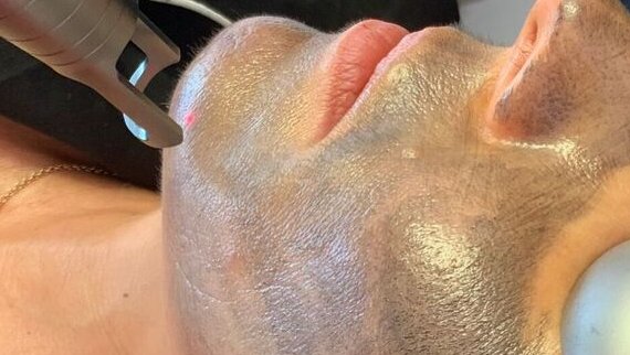 Hollywood Peel à Toulouse