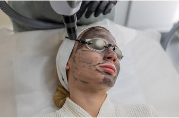 Hollywood Peel à Toulouse