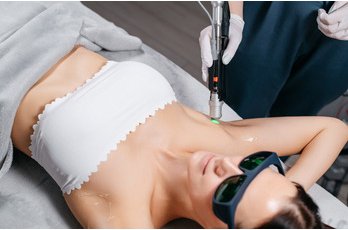 Comment les technologies laser ont évolué pour l'épilation médicale ?