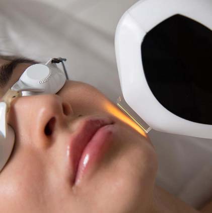 Lumière Pulsée (IPL)